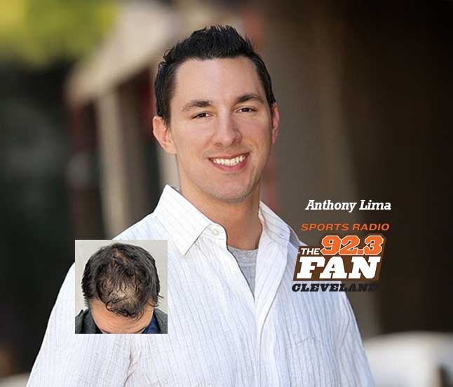 Medical-Grade-Scalp-&-Hair-Loss-Treatments-Van-Scoy-Cleveland-Ohio Medical-Grade Scalp & Hair Loss Treatments Van Scoy Cleveland Ohio
