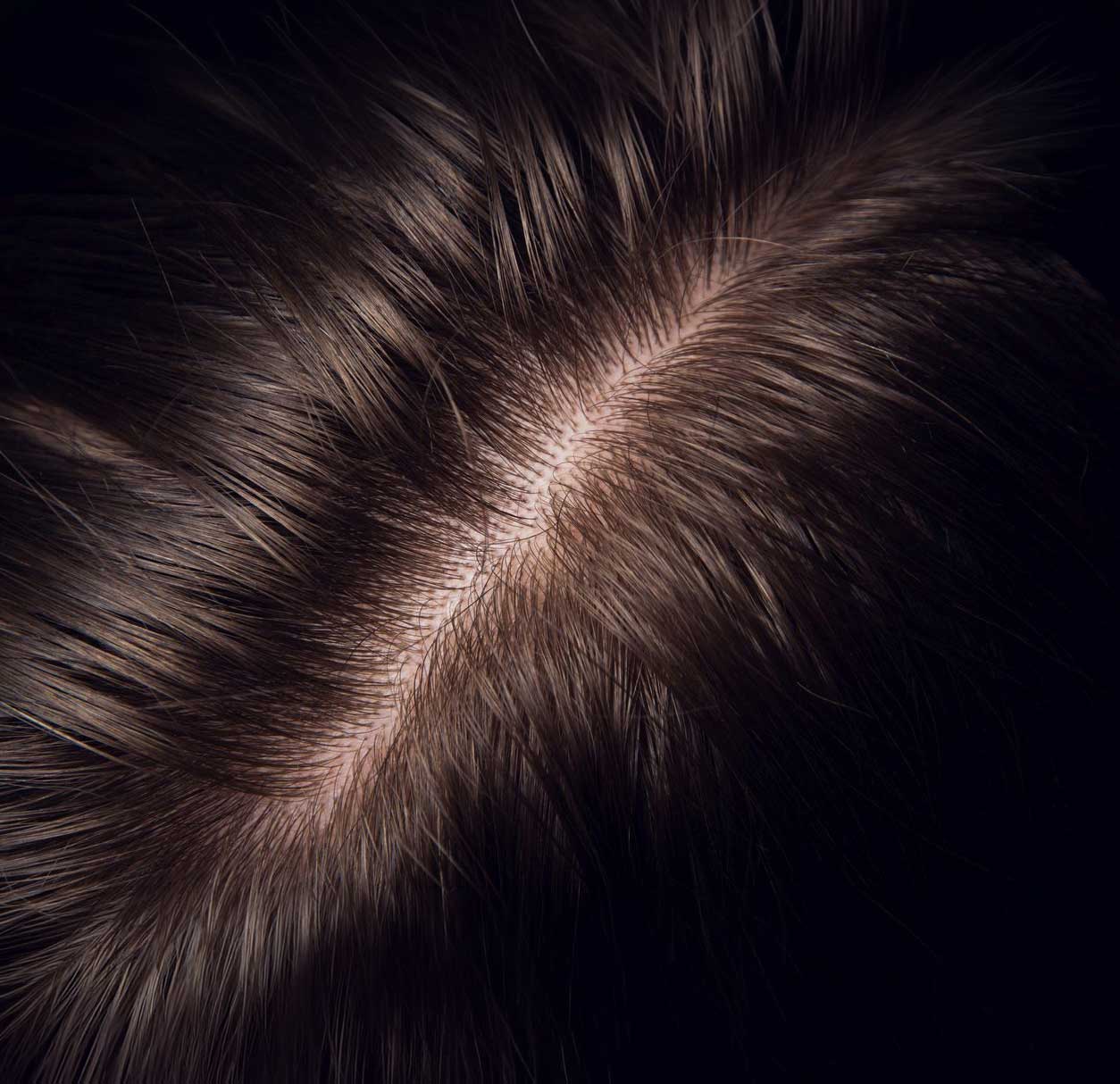 DERIVE-Hair-Loss-Treatment-Van-Scoy-Clinic-Cleveland-Ohio DE|RIVE plant-based hair wellness serum application at Van Scoy Hair Clinics in Ohio