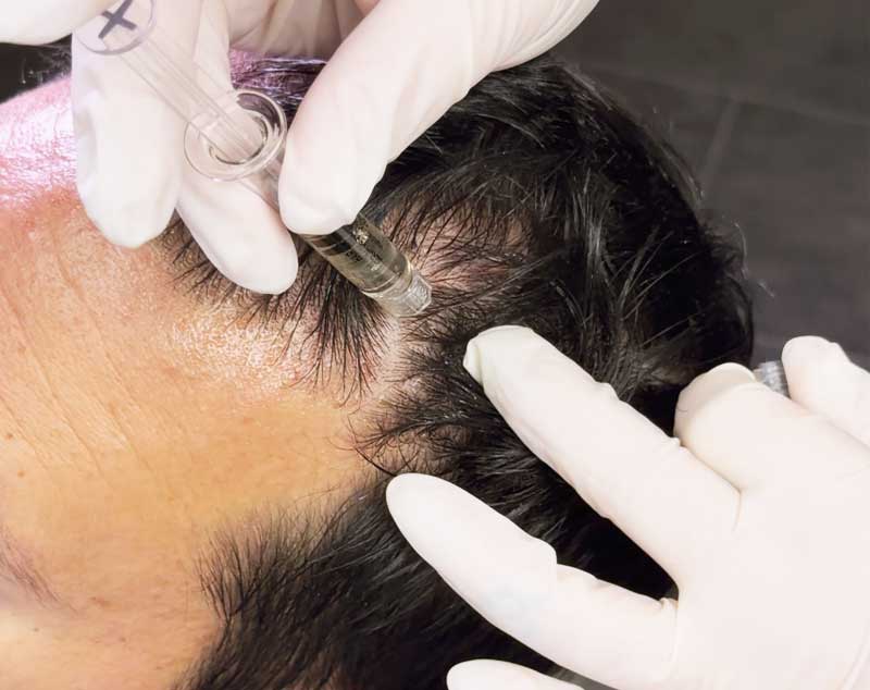 DeRive-hair-health-trichology-treatment-Cleveland-Ohio DeRive hair health trichology treatment Cleveland Ohio