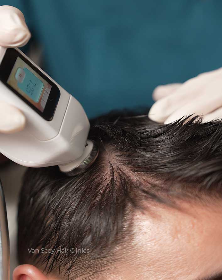 DeRive-trichology-treatment-cleveland-columbus-ohio DeRive trichology treatment at Van Scoy hair clinics in cleveland columbus ohio