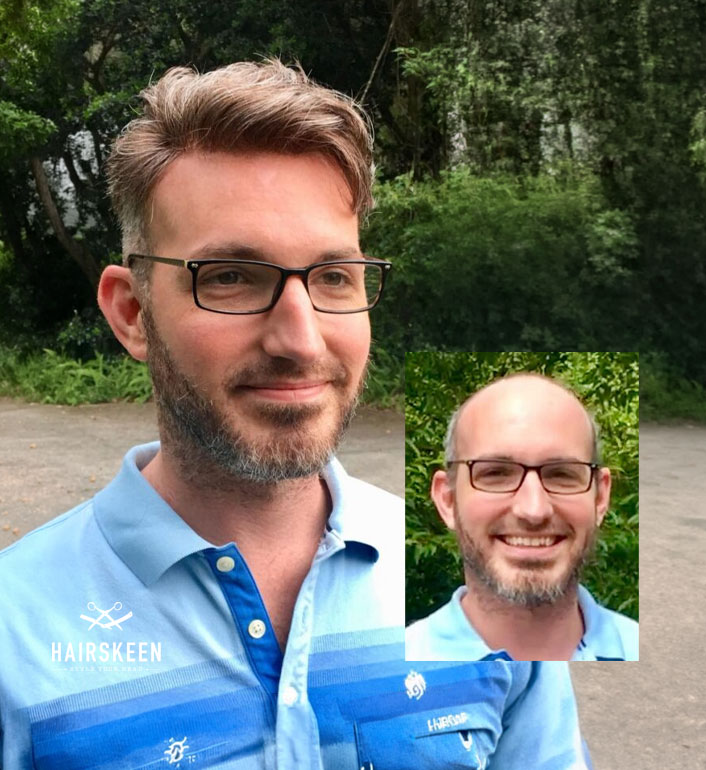 Hairskeen-European-Mens-custom-toupee-van-scoy-clinics-parma-columbus-ashland-ohio Hairskeen European Mens custom toupee van scoy clinics parma columbus ashland ohio