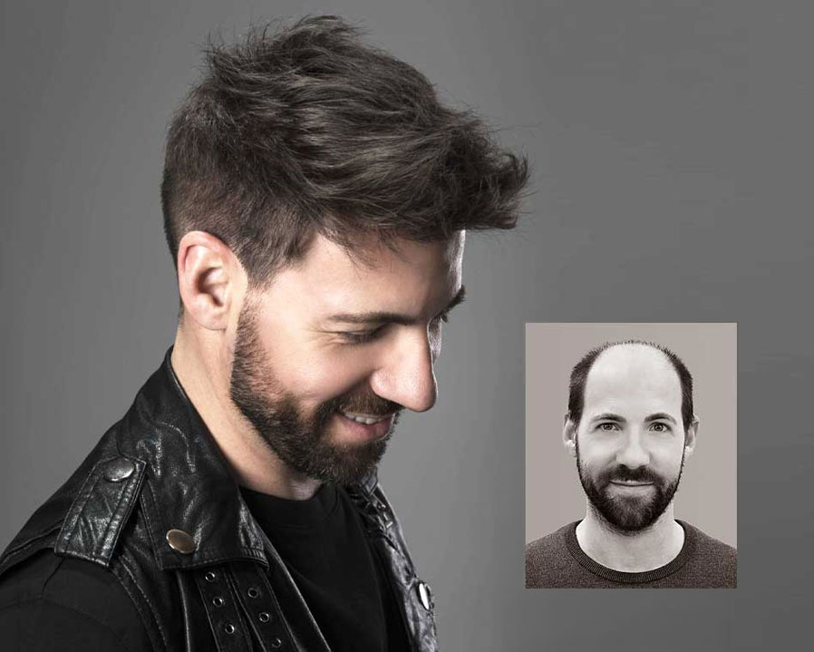Hairskeen-non-surgical-hair-replacement-van-scoy-ohio Hairskeen non-surgical hair replacement van scoy ohio