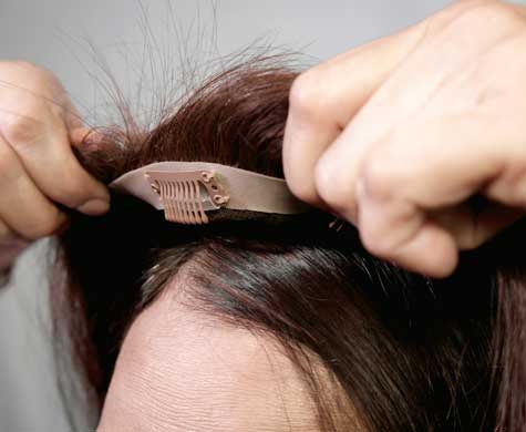 Medical Wigs & Hair Prosthesis Van Scoy Ohio