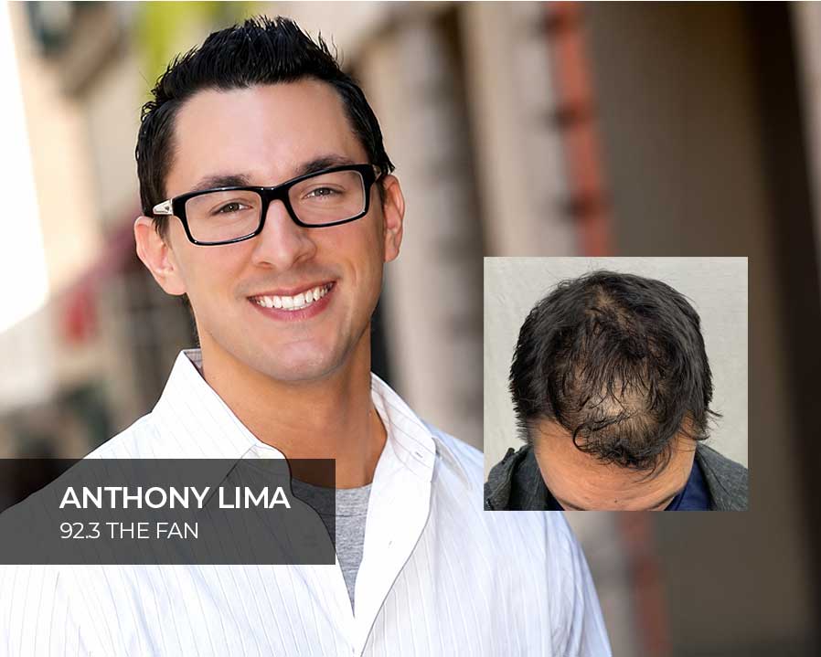 PRP-Hair-Rejuvination-Therapy-Anthony-Lima-92.3-The-Fan-Cleveland PRP Hair Rejuvination Therapy Anthony Lima 92.3 The Fan Cleveland