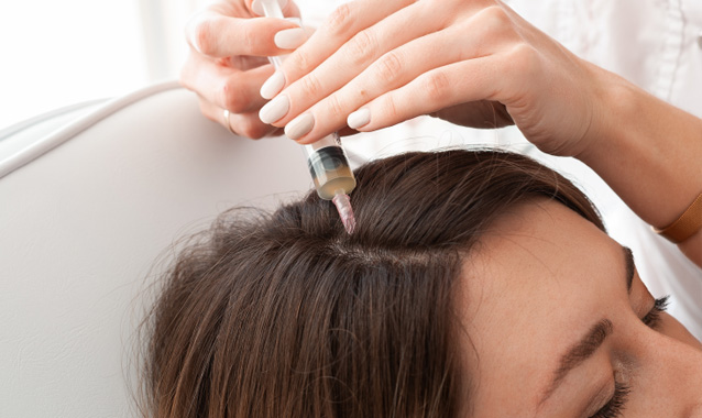 PRP-hair-loss-treatment-women-cleveland-columbus-ohio PRP hair regrowth treatment women cleveland columbus ohio