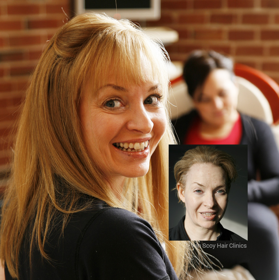 Van Scoy Medical Wigs & Hair Prosthesis Center Ohio