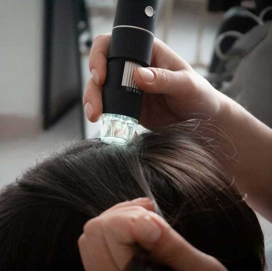 digital scalp analysis van scoy hair clinics trichology examination