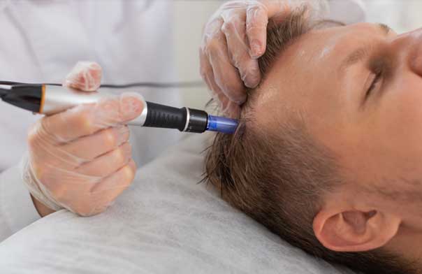 hair-regrowth-van-scoy-hair-clinics-cleveland-ashland-columbus-ohio hair regrowth van scoy hair clinics cleveland ashland columbus ohio