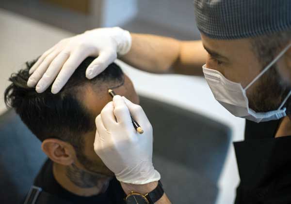 hair-transplant-procedure-what-to-expect-van-scoy-clinics hair transplant procedure what to expect van scoy clinics