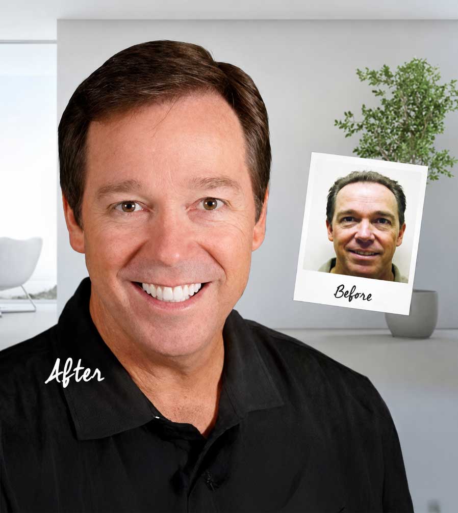 Hair Transplants Cleveland Van Scoy Hair Restoration Clinic