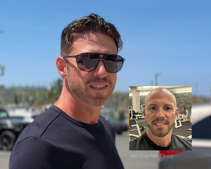 mens-non-surgical-hair-replacement-cleveland-columbus-ashland-ohio non-surgical men's hair replacement cleveland columbus ashland ohio