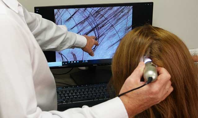 van-scoy-hair-clinics-initial-consultation-scalp-health van scoy hair clinics initial consultation scalp health