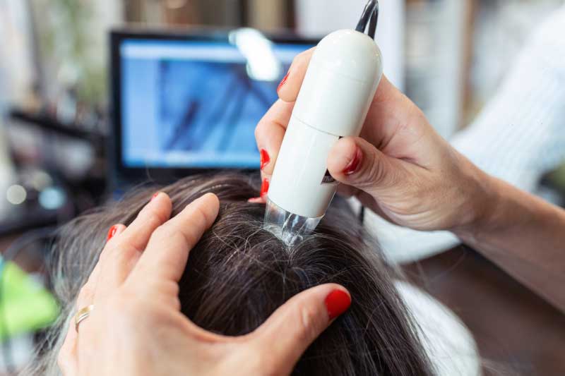 Van Scoy Hair Clinics Hair Loss Treatment FAQ