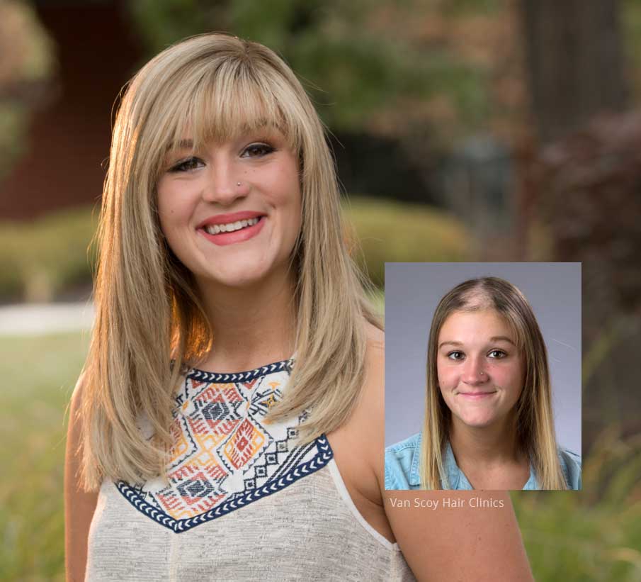 womens custom hair systems van scoy clinic cleveland ashland columbus ohio