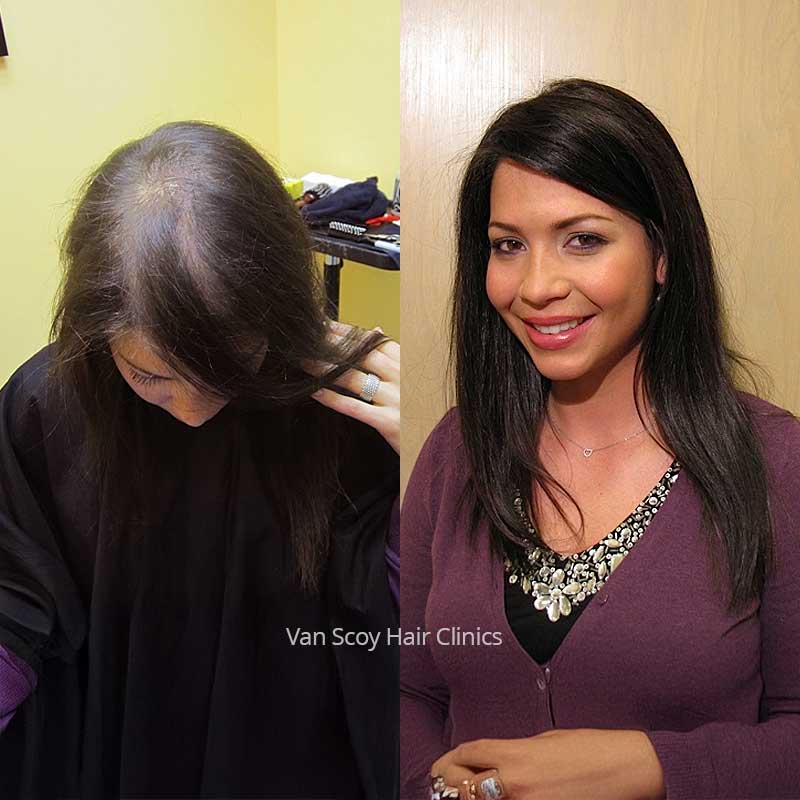 Women's non-surgical hair replacement results. Maria, Van Scoy Cleveland Columbus