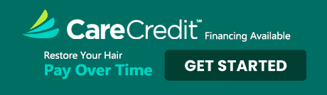 Care Credit hair restoration financing at Van Scoy Hair Clinics
