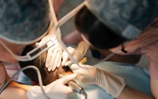 bad hair transplant second opinion